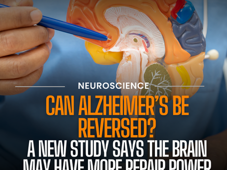 Restoring NAD+ Reverses Alzheimer’s in Preclinical Models, Study Shows
