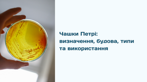 Що ви знаєте про чашку Петрі?
