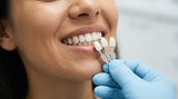 Anthony Barnes Porcelain Veneers.jpeg