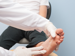 Warts: Painless Wart Removal for Adults and Children 