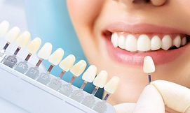 estetica-dental-scaled-1_edited.jpg