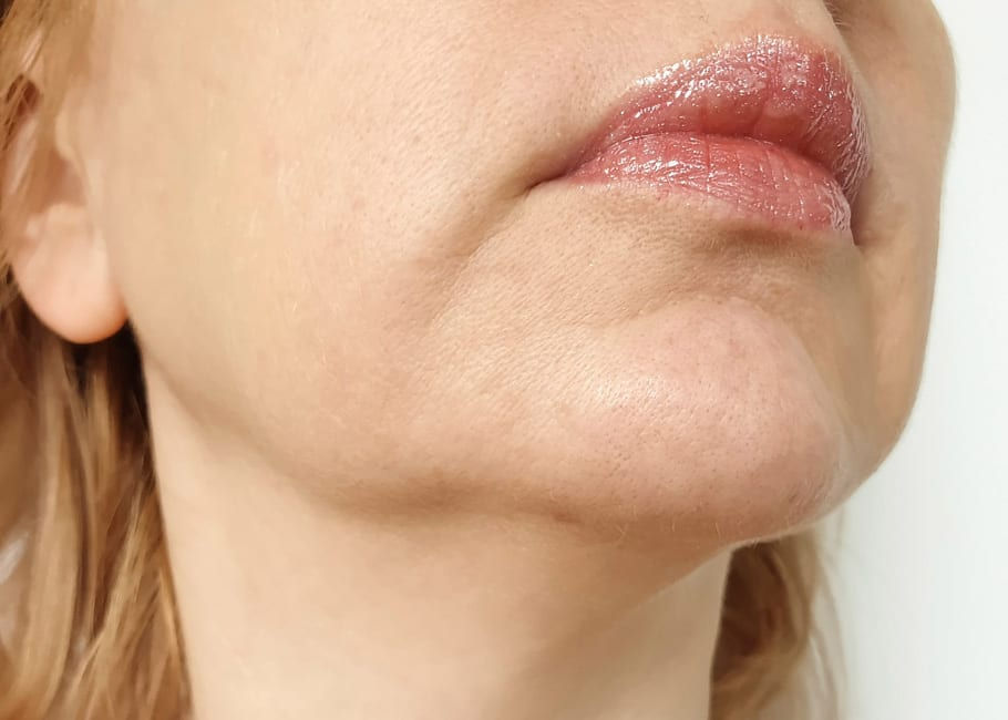The Top 3 Treatments I Recommend for Facial Rejuvenation After Weight Loss