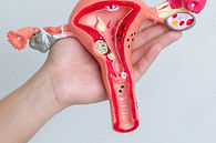 PCOS care by Dr. Harshita Pandey