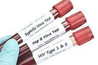 Treatment of STDs by Dr. Harshita Pandey