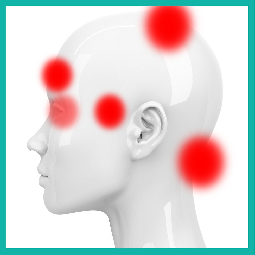 image of a white head model with red areas highlighting typical headache pains. Red over the eye, forehead, temple, top of head and base of neck.
