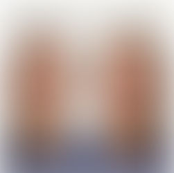 Why your cheeks look FLAT after hitting 30! The Hidden cause of ageing (and what you can do about it!)