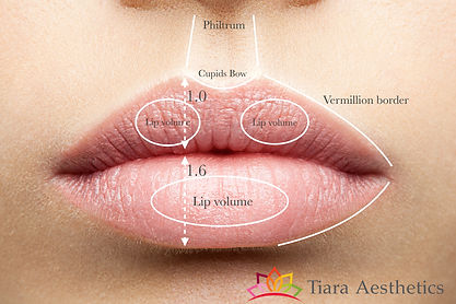 Lip Fillers