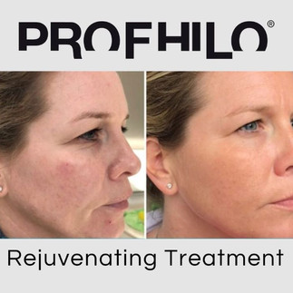 Close-up of healthy facial skin showing smooth texture and natural radiance.