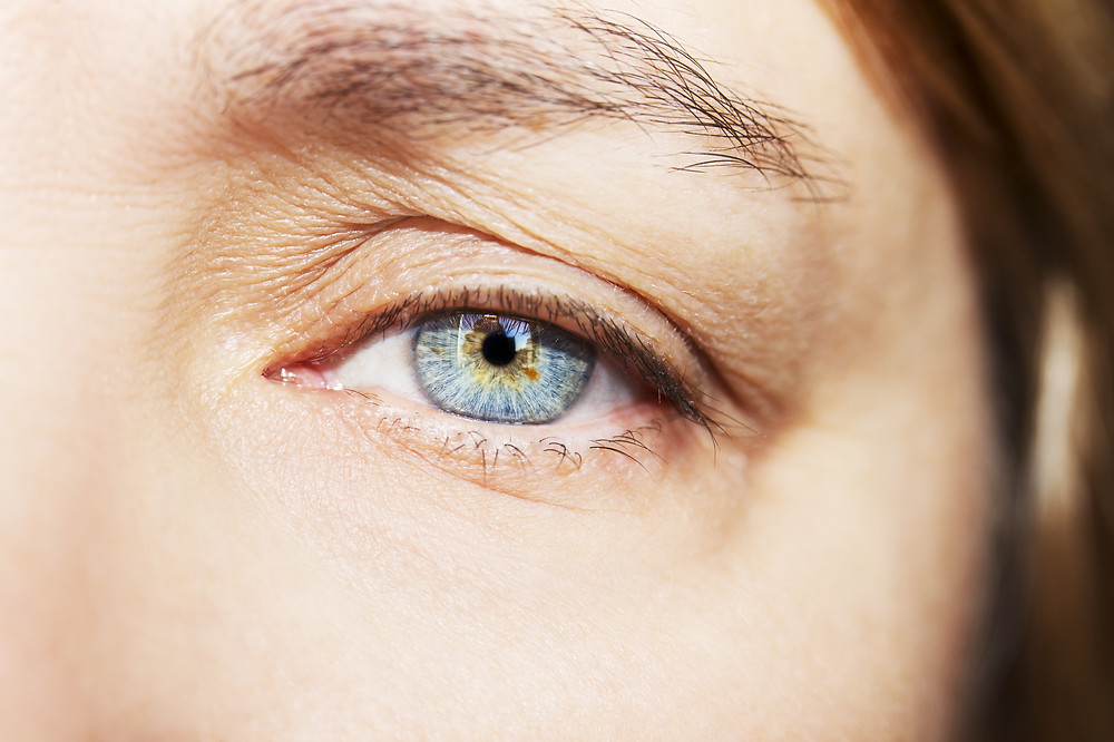 Droopy Eye lids