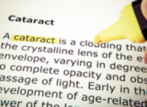Cataracts