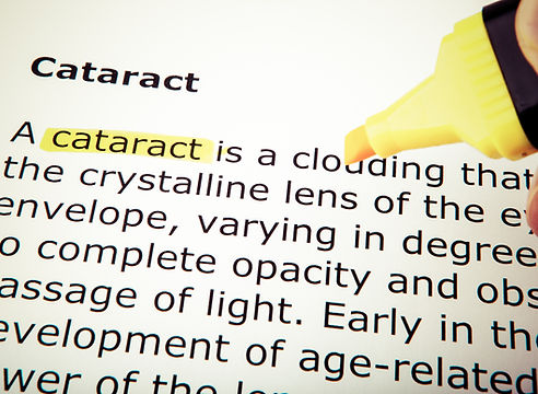 Cataracts