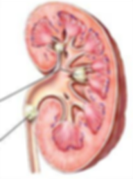 Prostatectoma radical