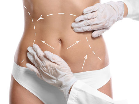 Conoce todo sobre la LIPOESCULTURA HD