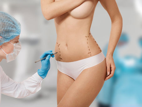Cirugía plástica: Descubre los beneficios más allá de la estética con Liposoft
