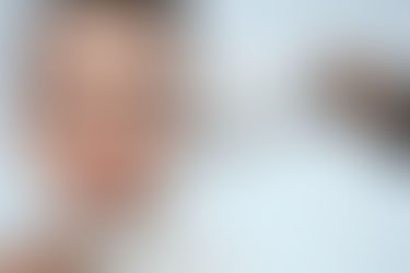 ¿Qué es la Blefaroplastia?