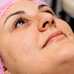 fernanda 1 antes.JPG