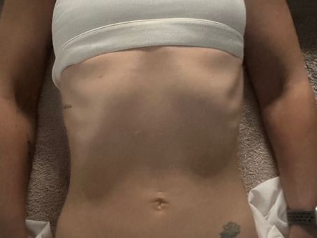 Maximize Your Results After a Lymphatic Drainage Massage