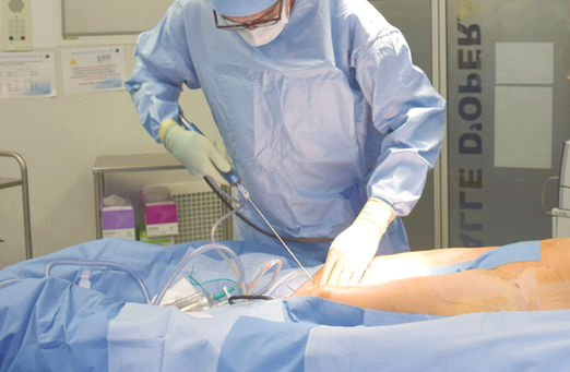 LIPOSUCTION