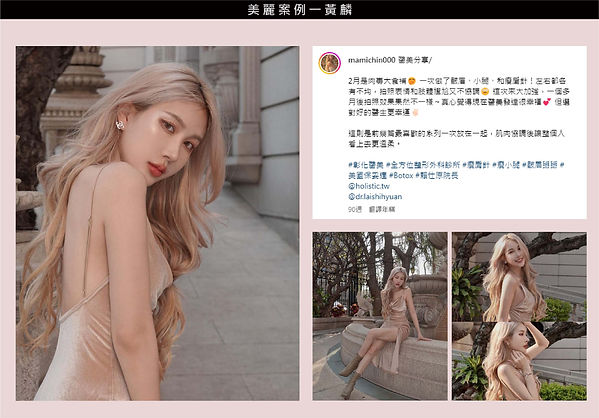 瘦肩針 彰化 醫美 推薦 肉毒 肉毒桿菌 肌肉痠痛 美人肩 圓肩 改善 肩頸痠痛 斜方肌 上斜方肌