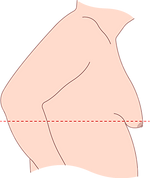 男性女乳 手術 醫美 診所 彰化