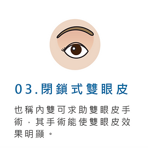 雙眼皮 彰化 醫美 整形外科 整形 推薦 中部 內雙 外雙