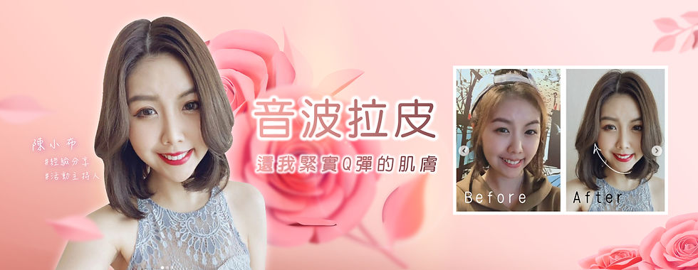 音波 電波 彰化 醫美 推薦 整形 整形外科 中部