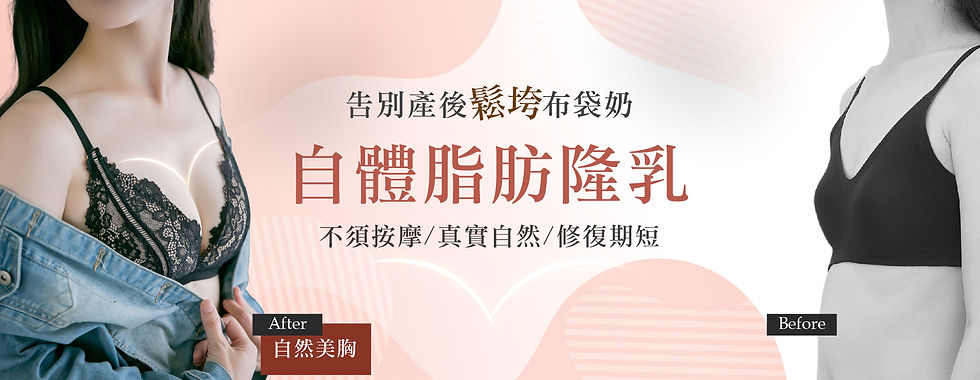 自體脂肪隆乳_改-01.jpg