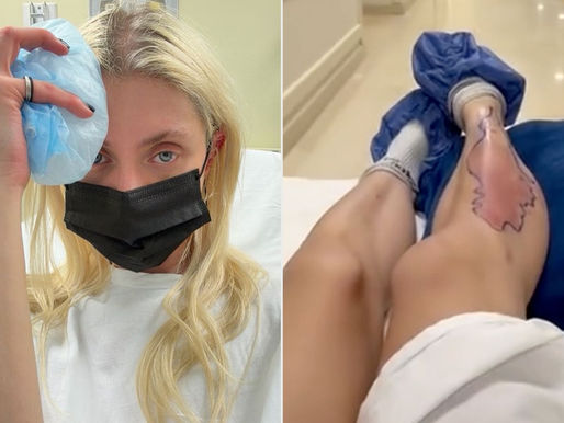 Taylor Momsen Hospitalized After Suffering Poisonous Spider Bite