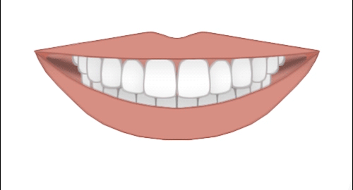 Esthetic-Contouring.gif