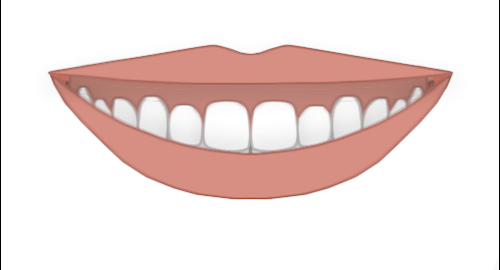 SMILE-VIP4.gif
