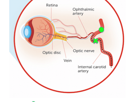 3 April 2019 - EUA #15
