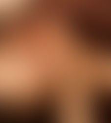 乾燥がきになる季節です