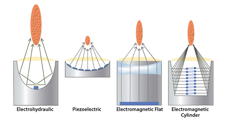 shock waves