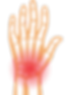 Hand/Wrist Pain