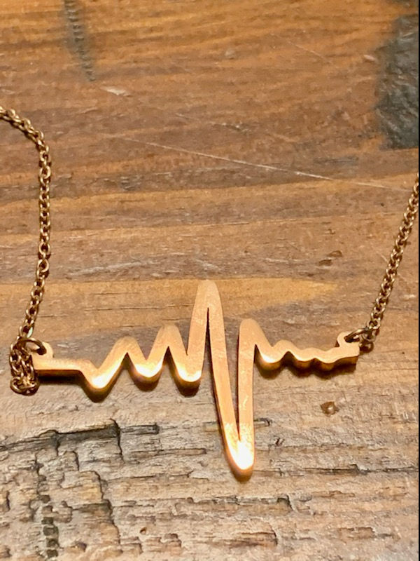 Two Passionate Hearts Beating in Time