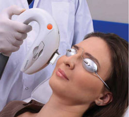 IPL Dry Eye Treatment