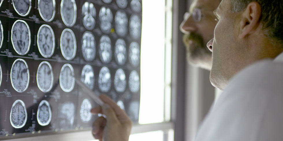 Two people examine brain scans on a lightbox. One points with a pen. The scene is focused, professional, and in a clinical setting.