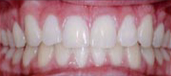 Orthodontics 3