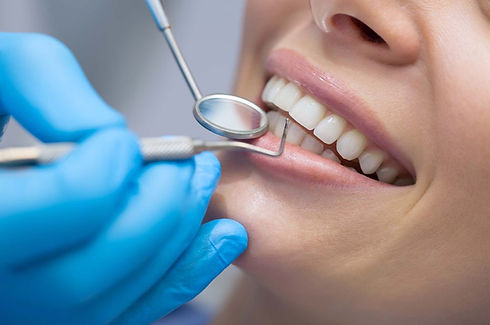 teeth whitening