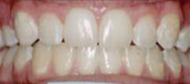 Orthodontics 2