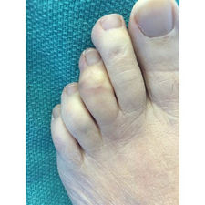 Three-Month Follow-Up