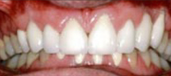 Combination Treatments 2
