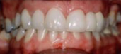 Combination Treatments 4