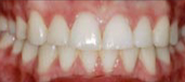 Orthodontics 12