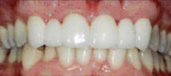 Combination Treatments 1