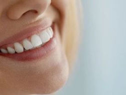 Professional teeth whitening vs. store-bought alternatives