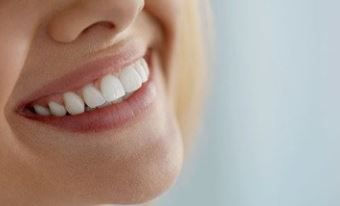 Professional teeth whitening vs. store-bought alternatives