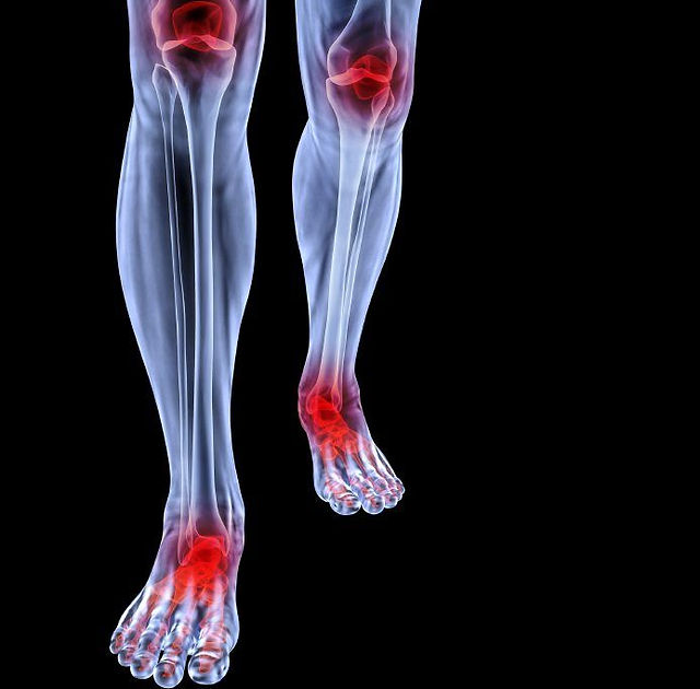 Foot pain on x-ray on black background