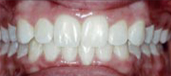 Orthodontics 11