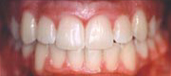 Orthodontics 7